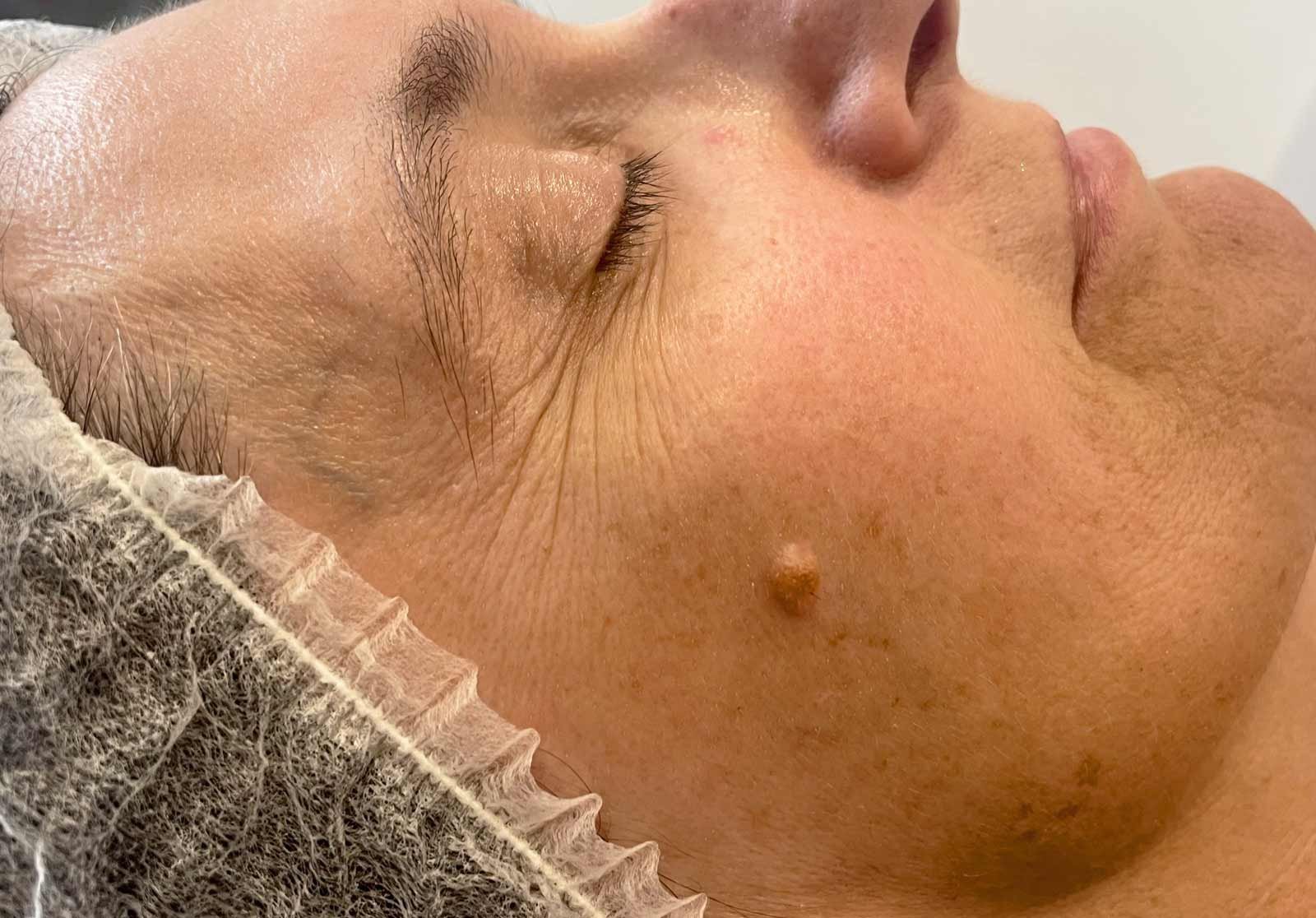 Soin visage profond pour homme au Mont Spa Les Trésoms à Annecy, dans un espace de bien-être dédié.