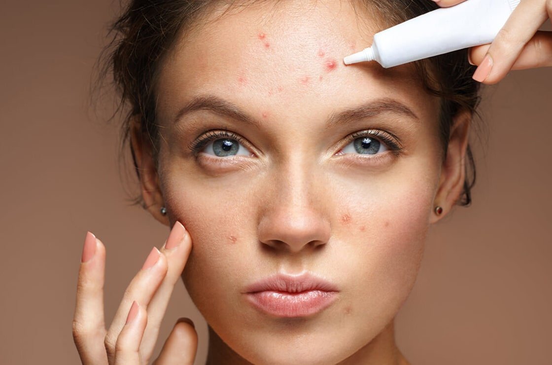 Soin purifiant au Mont Spa Les Trésoms à Annecy, pour éliminer les imperfections et purifier la peau.