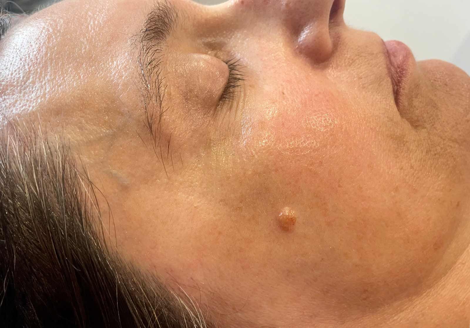 Soin anti-âge visage au Mont Spa Les Trésoms à Annecy, pour atténuer les rides et lisser la peau.
